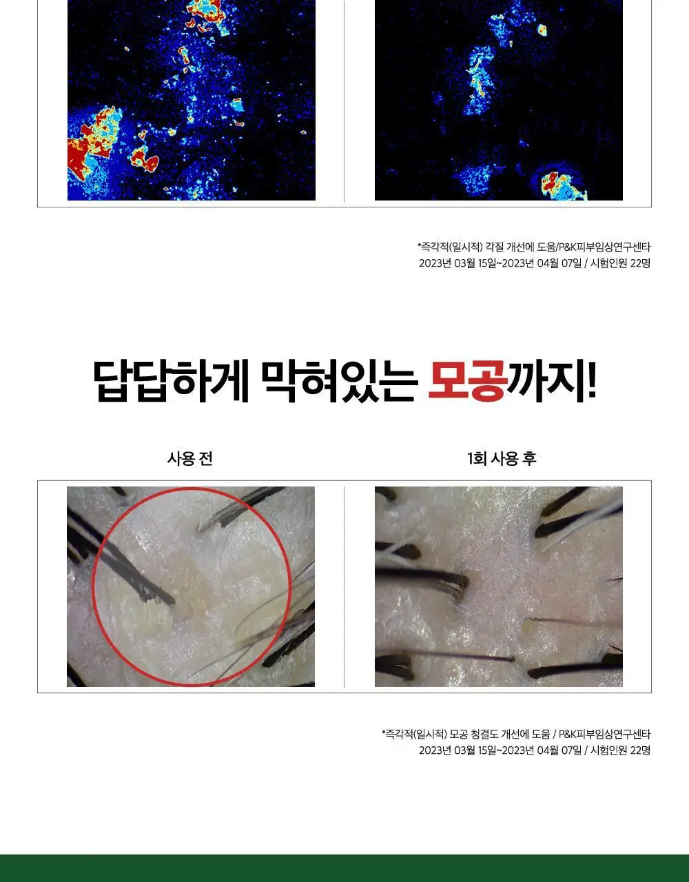 [대용량] CKD 아미노 비오틴 두피 각질 샴푸 750ml 상세페이지 12
